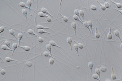 Moule (Mytilus edulis) - Spermatozoïdes x400